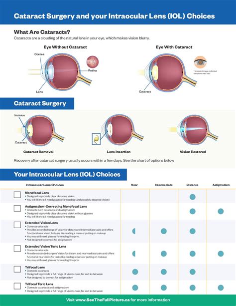 Click here to see detailed price list for all consultations and procedures. . Cataract lens price list